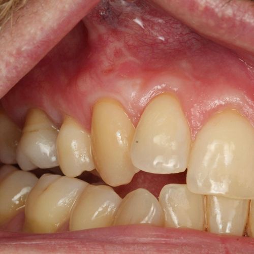 dentist burnham high street