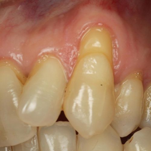 gum specialist near me