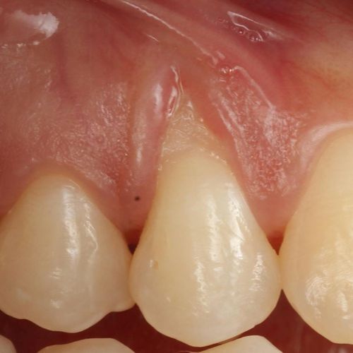 gum specialist near me