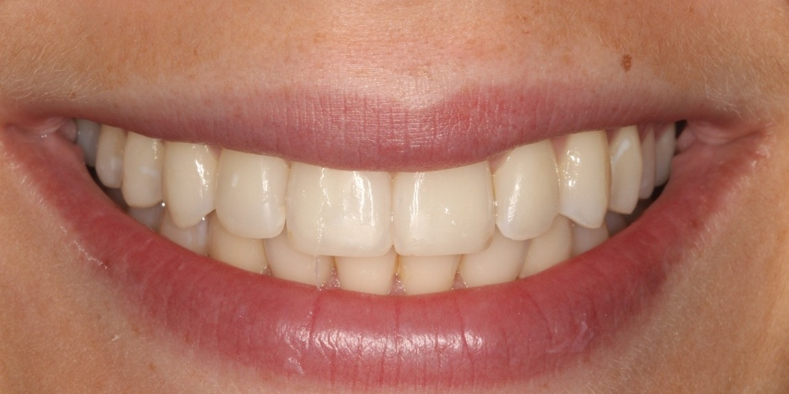 burnham dental practice