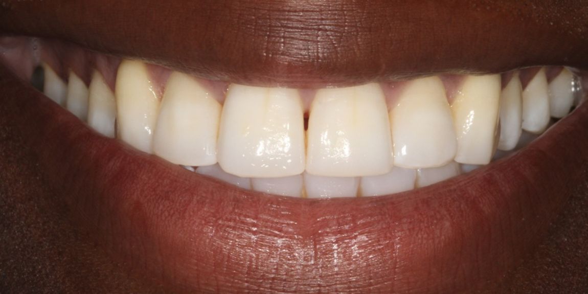 burnham dental practice